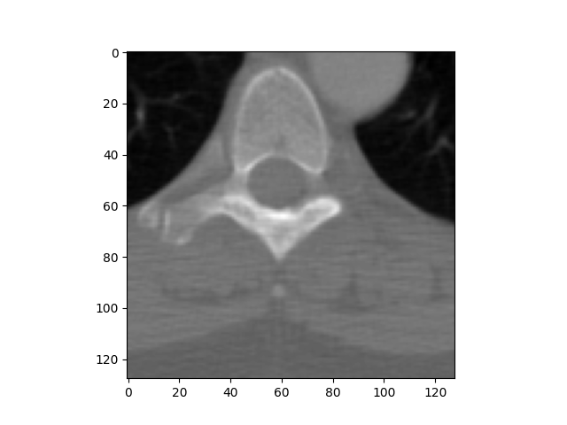Rendered CT slice from a DICOM file, showing the visible pixel layer that sits on top of DICOM metadata and workflow context.