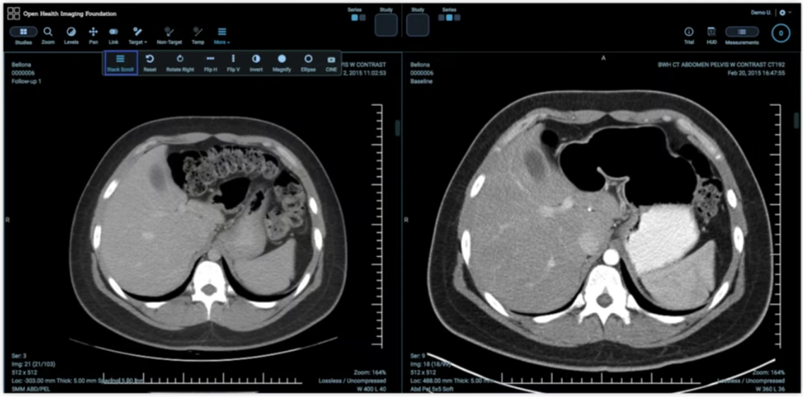 Official Google Cloud Medical Imaging Suite overview image showing imaging data management, AI workflows, and clinical collaboration around Google Cloud imaging services.